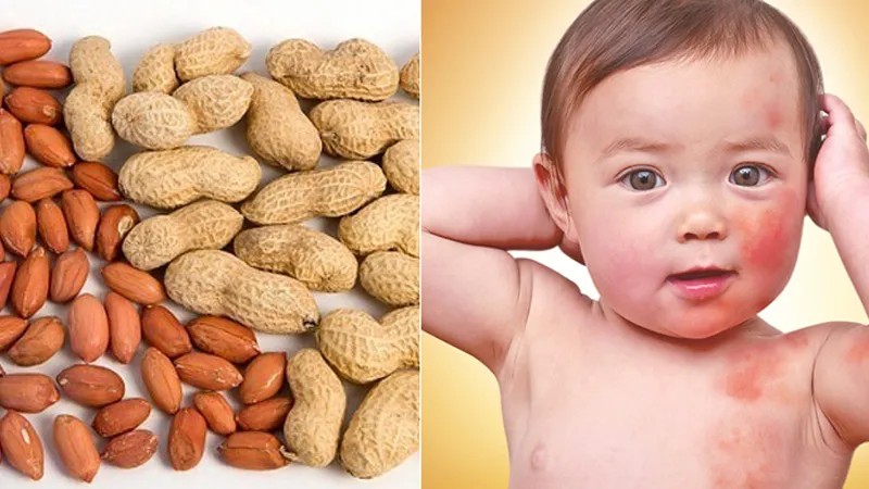 Đậu phộng là nguồn dinh dưỡng tuyệt vời hỗ trợ sự phát triển khỏe mạnh của trẻ nhỏ