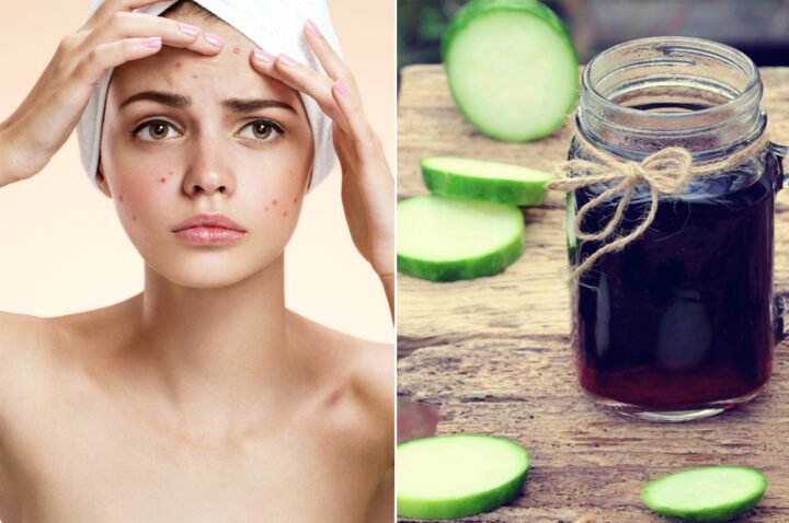 Cách nấu nước bí đao trị mụn thanh nhiệt